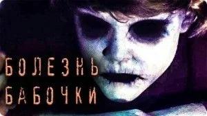 Болезнь Бабочки